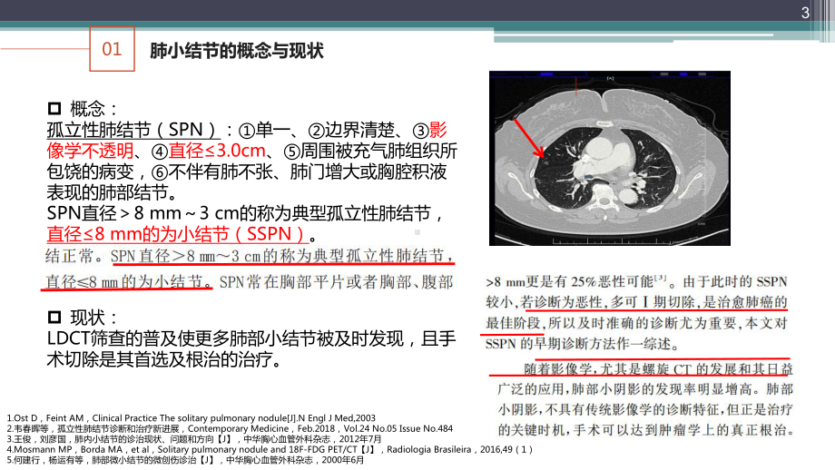 肺小结节定位和肺段切除规划PPT学习课件.ppt_第3页