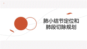 肺小结节定位和肺段切除规划PPT学习课件.ppt