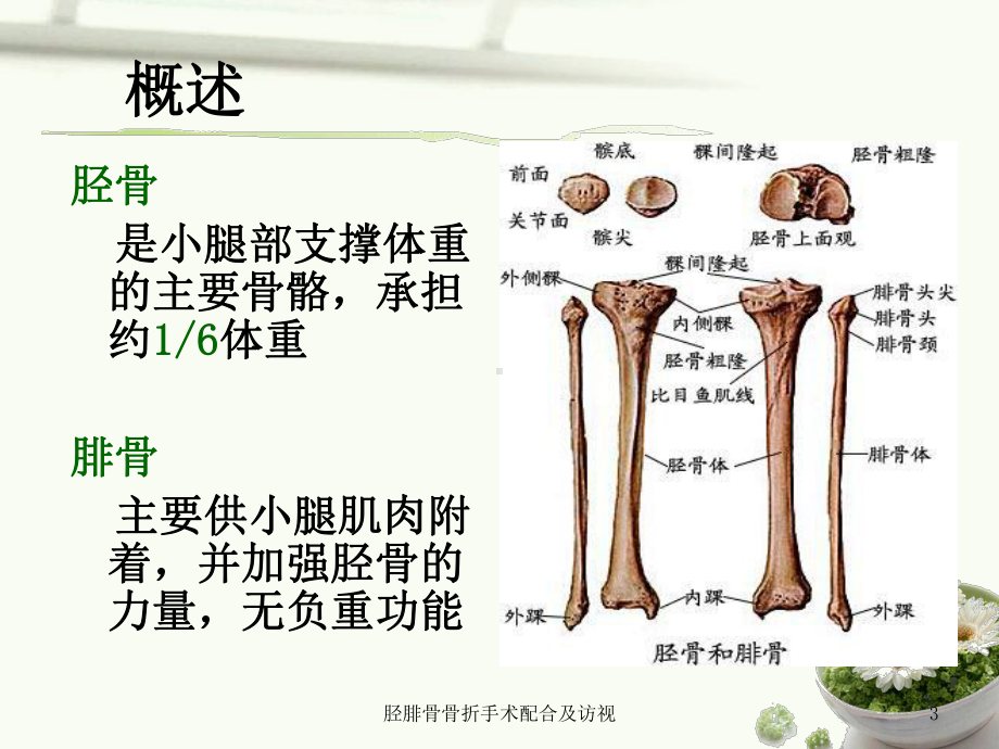 胫腓骨骨折手术配合及访视课件.ppt_第3页