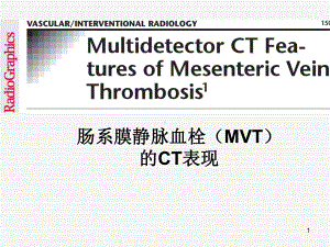 肠系膜静脉血栓(MVT)的CT表现PPT医学课件.ppt