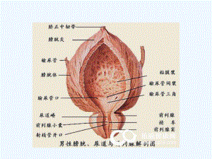 膀胱肿瘤病人的护理查房课件.ppt