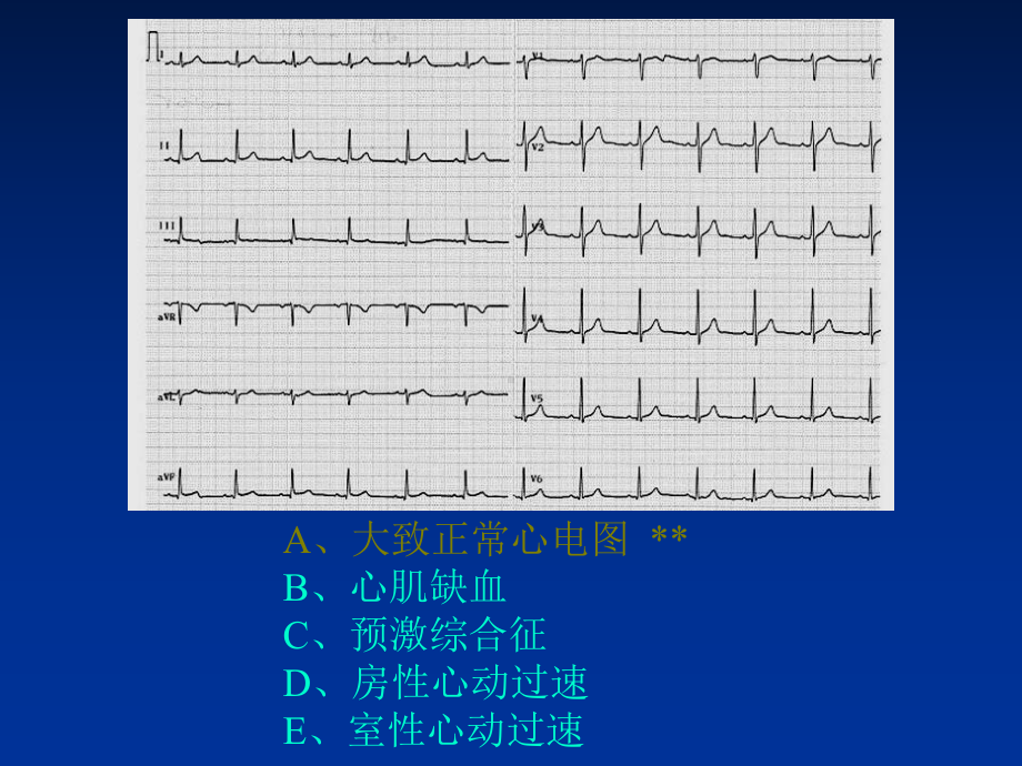 规范化培训之辅助检查结果判读方案课件.ppt_第2页