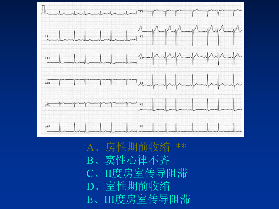 规范化培训之辅助检查结果判读方案课件.ppt_第3页