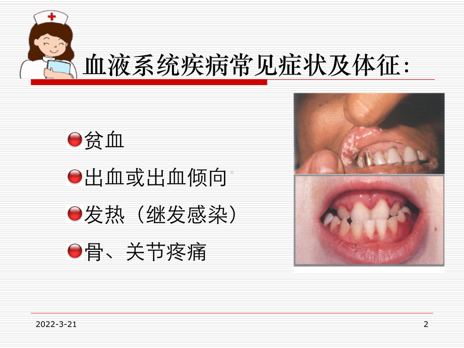 血液科疾病常见症状护理PPT课件.ppt_第2页