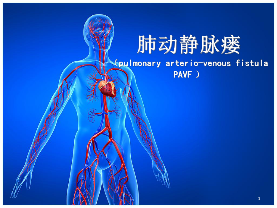 肺动静脉瘘PPT医学课件.ppt_第1页