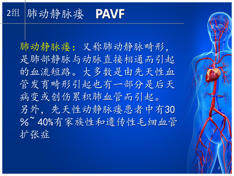 肺动静脉瘘PPT医学课件.ppt_第2页