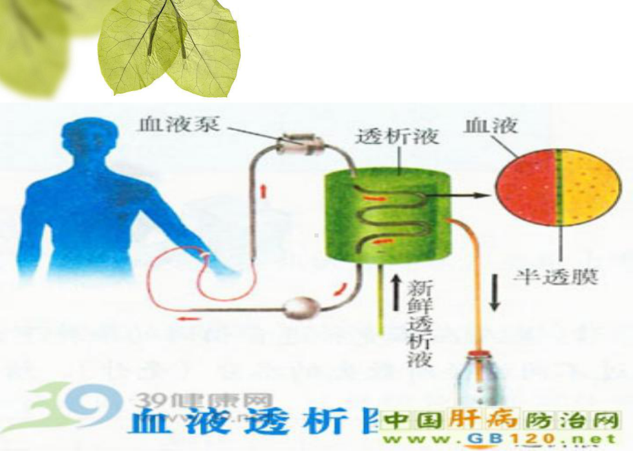 血液透析相关知识PPT课件.ppt_第2页