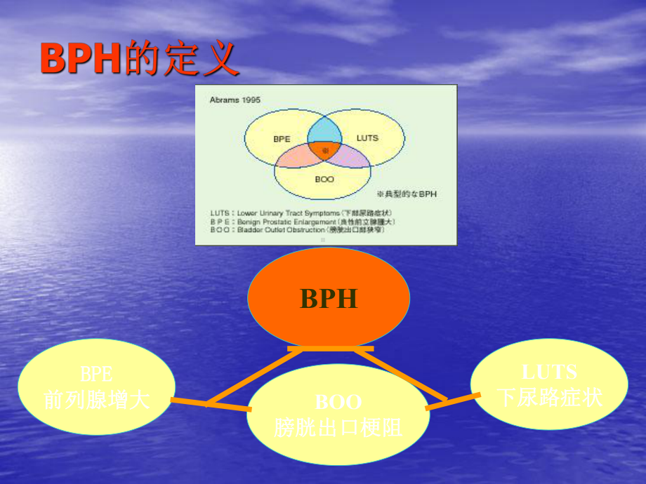 良性前列腺增生症诊疗规范ppt课件.ppt_第2页