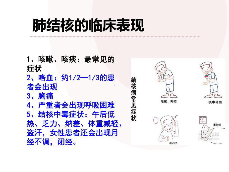 肺结核并咯血病人的护理ppt演示课件.ppt_第3页