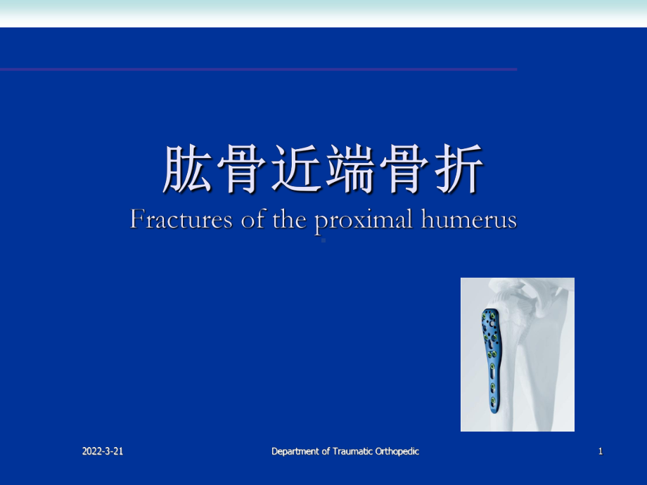 肱骨近端骨折ppt演示课件.ppt_第1页