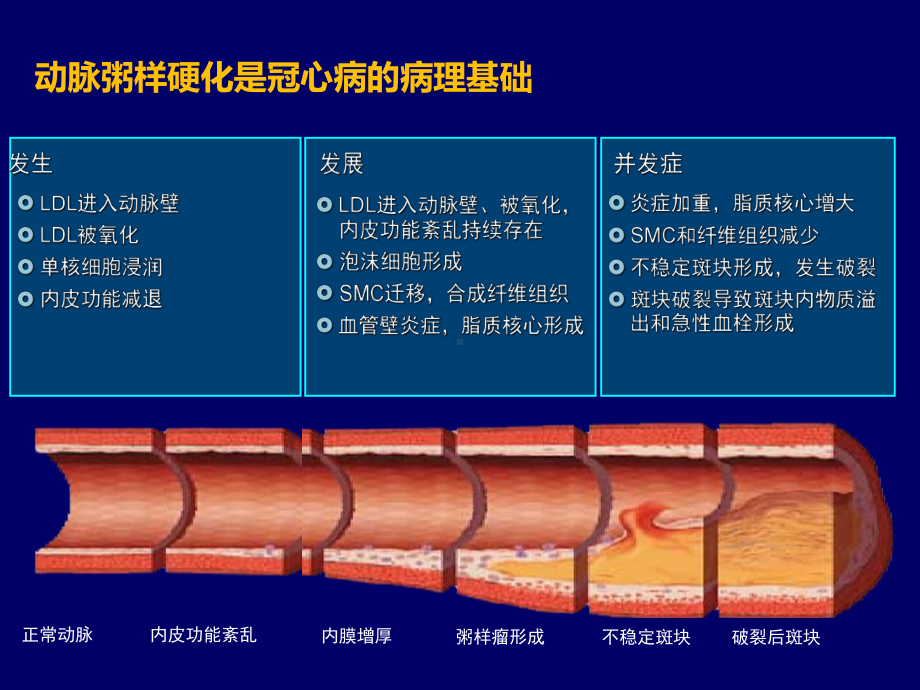 血栓形成机制和临床抗栓策略PPT幻灯片课件.pptx_第2页