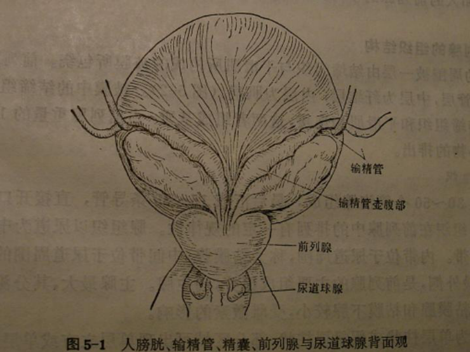 良性前列腺增生症BPH课件.ppt_第2页