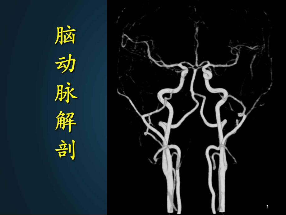 脑动脉解剖与临床PPT演示课件.ppt_第1页