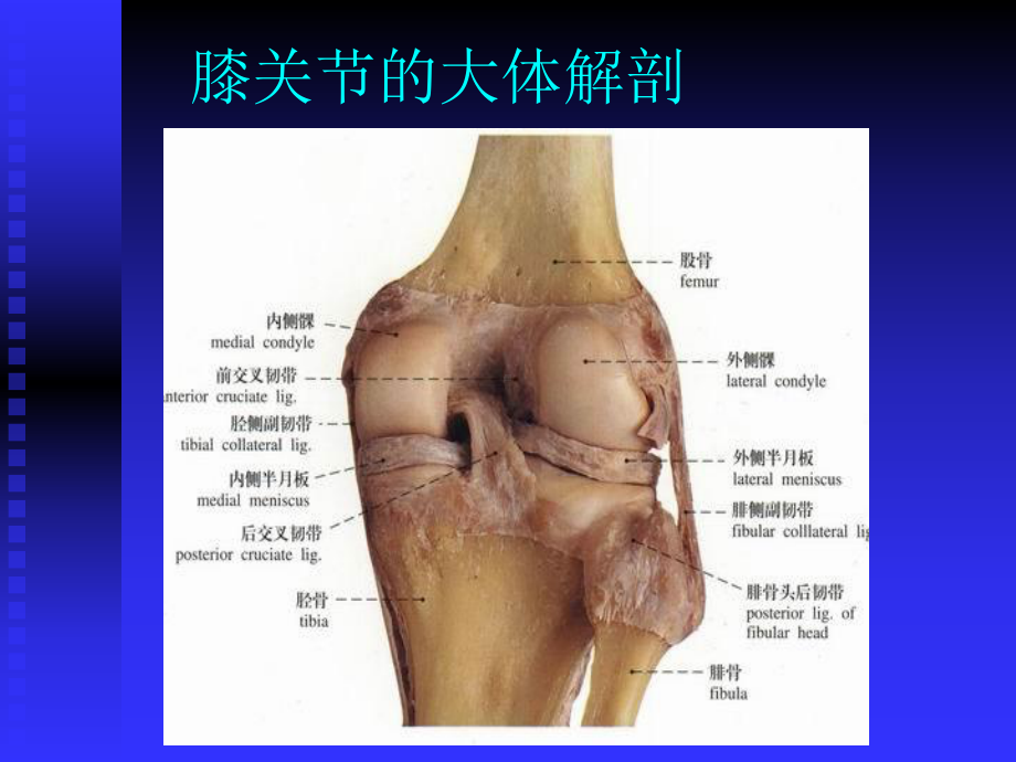 膝关节常见病的诊断与治疗分析课件.ppt_第3页