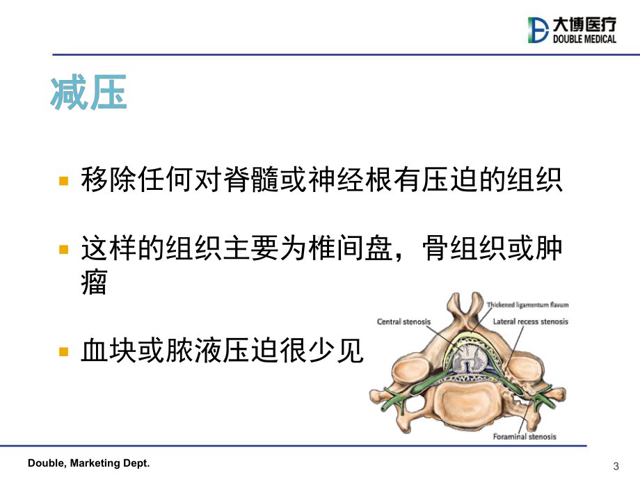 脊柱外科手术原则PPT课件.ppt_第3页