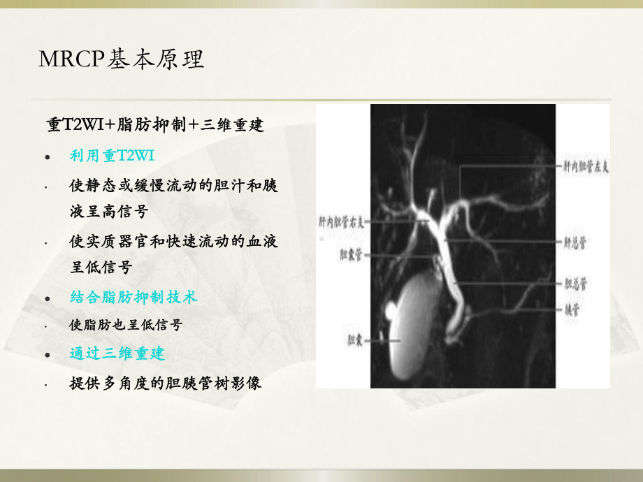 胆总管结石PPT医学课件.ppt_第2页