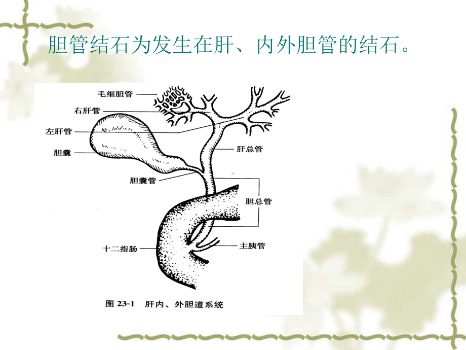 肝内胆管结石病人的护理ppt演示课件.ppt_第2页