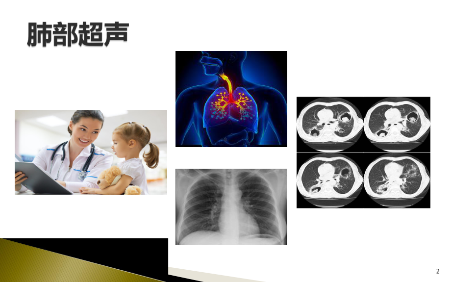 肺部超声的临床应用PPT演示课件.ppt_第2页