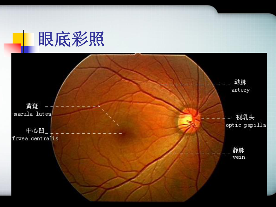 视网膜中央静脉阻塞的诊断及治疗-PPT课件.ppt_第3页