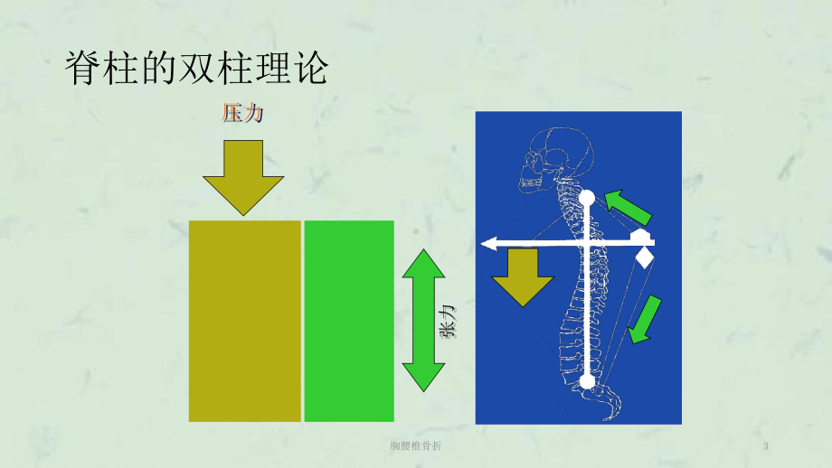 胸腰椎骨折课件.ppt_第3页