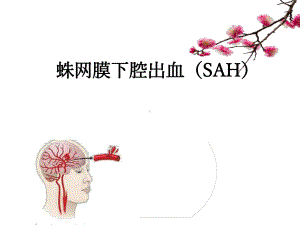 蛛网膜下腔出血的进展与护理课件.ppt