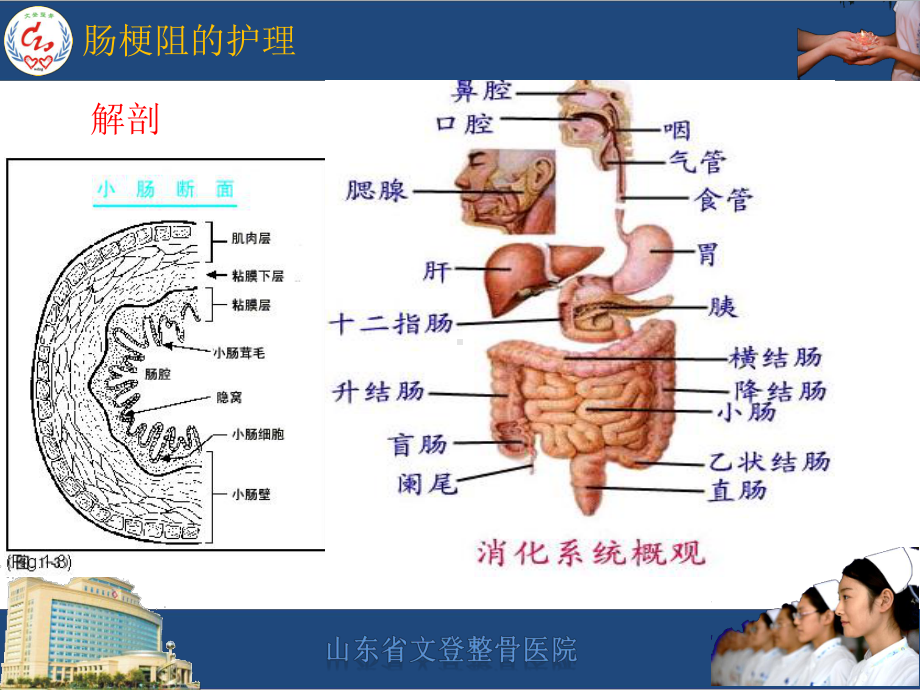 肠梗阻护理PPT课件.pptx_第3页