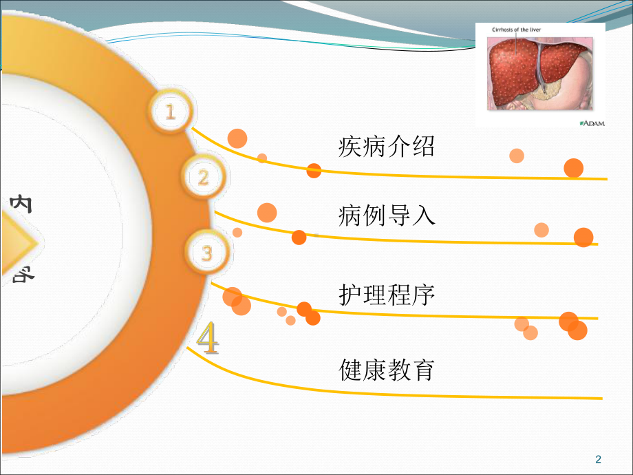 肝硬化病人的护理查房ppt演示课件.ppt_第2页