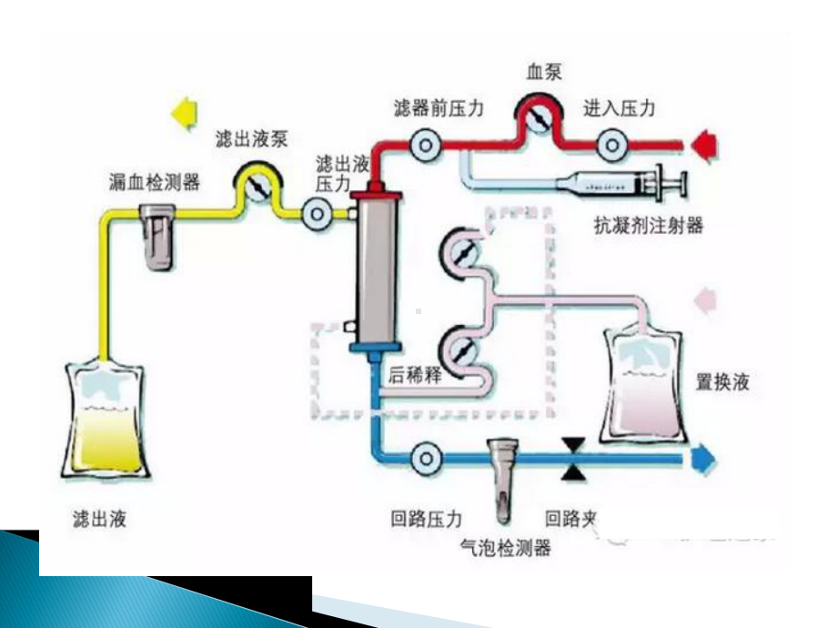 血液透析护理操作过程中风险管理课件.pptx_第2页