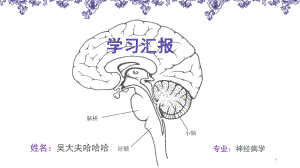 脑桥梗死&孤立性脑桥梗死PPT参考课件.ppt