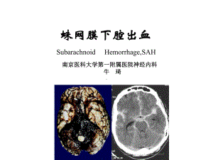 蛛网膜下腔出血教案word版本课件.ppt