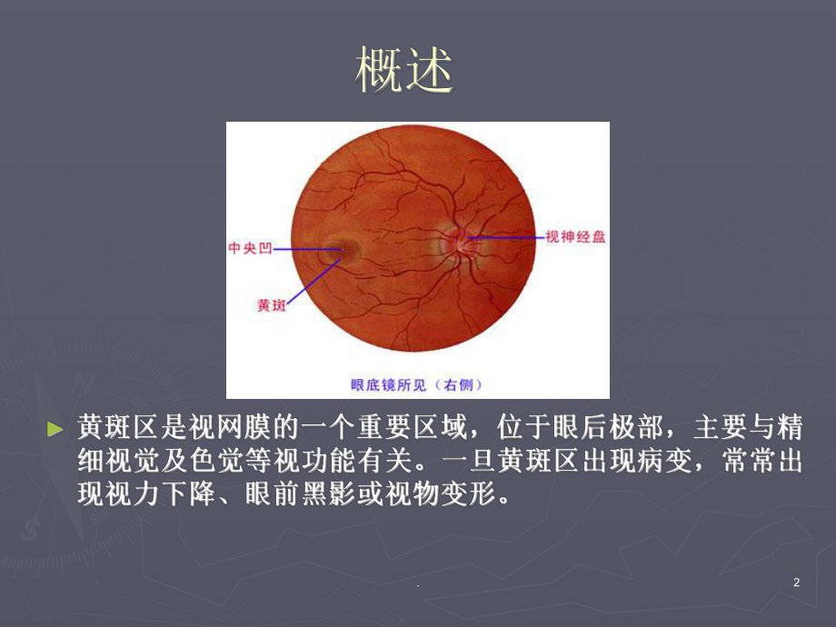 老年性黄斑变性PPT医学课件.ppt_第2页