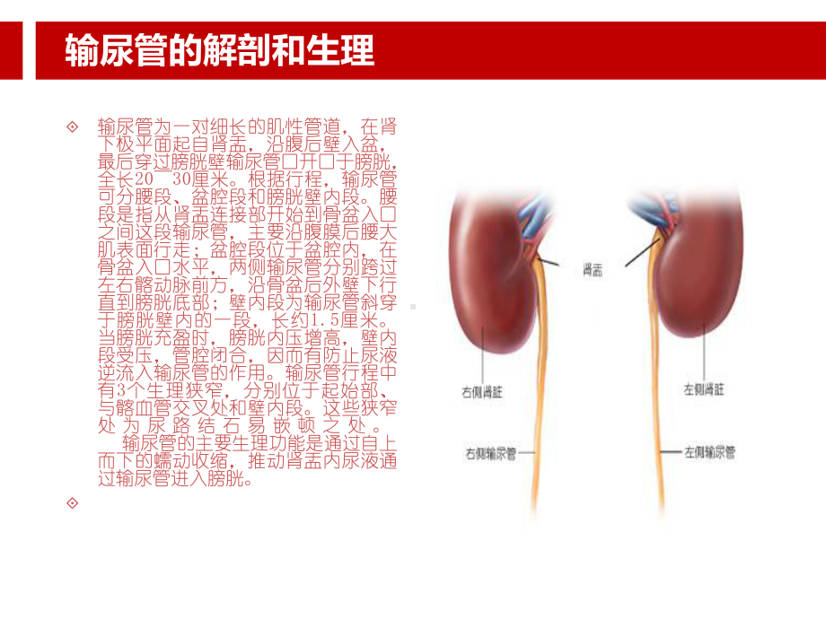 输尿管钬激光碎石术.ppt课件.ppt_第3页