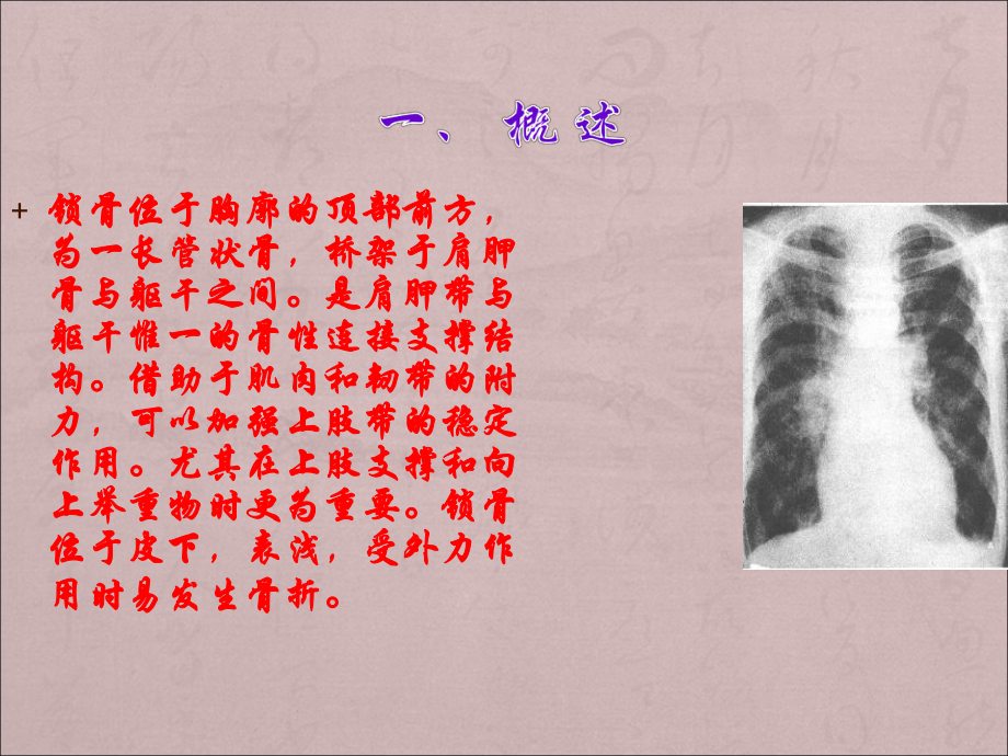 锁骨骨折PPT课件.ppt_第3页