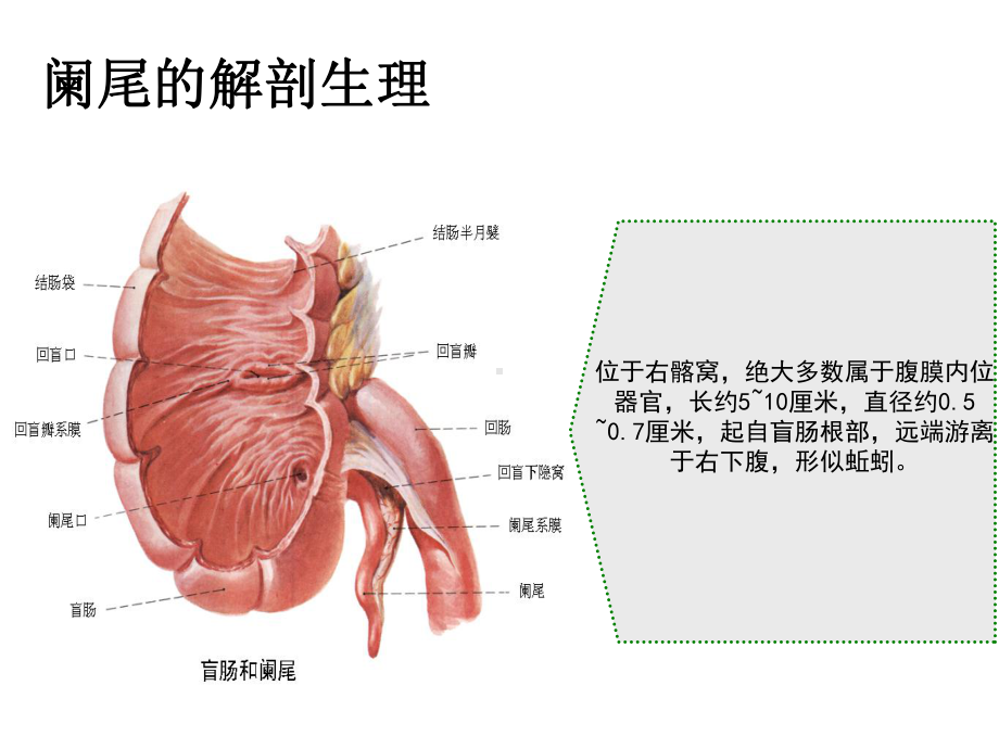 阑尾炎腹腔镜术前术后护理课件.ppt_第3页