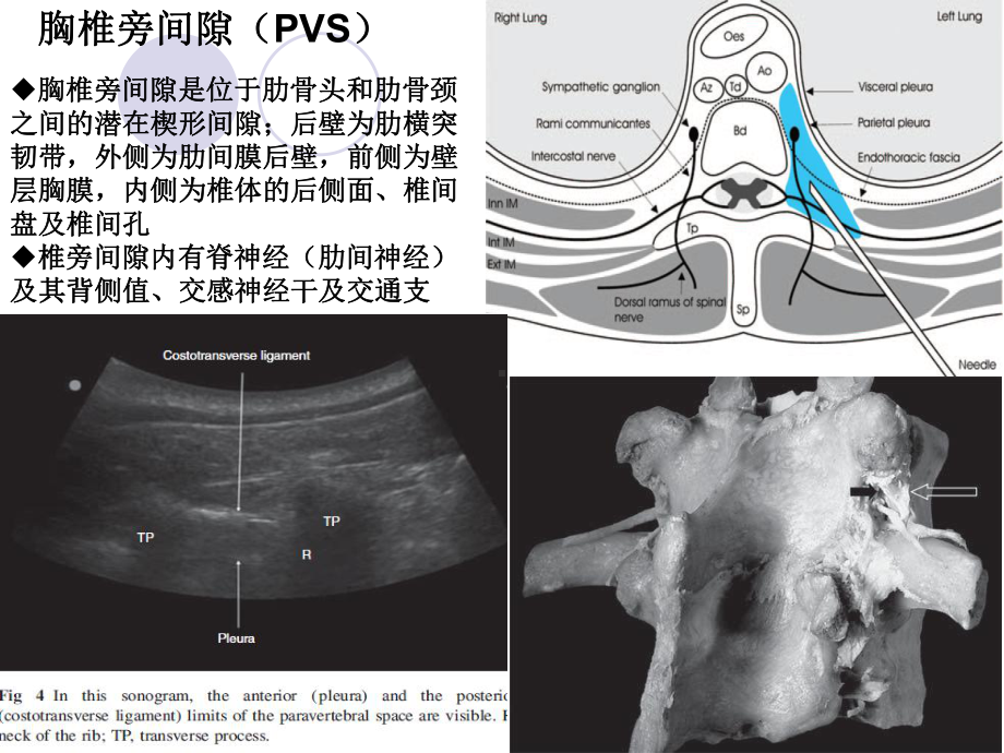 超声引导下的神经阻滞PPT课件.ppt_第3页