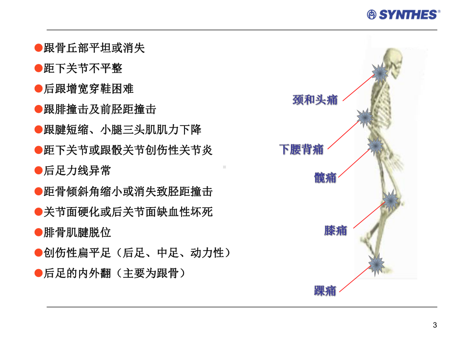 陈旧性跟骨骨折的手术治疗PPT幻灯片课件.ppt_第3页