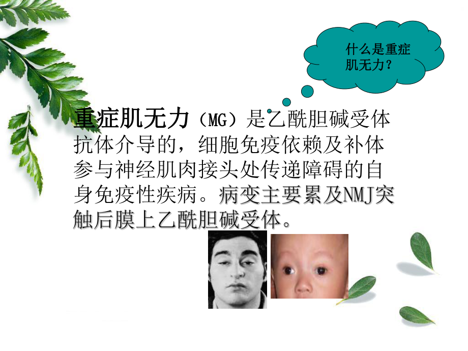 重症肌无力PPT课件.ppt_第2页