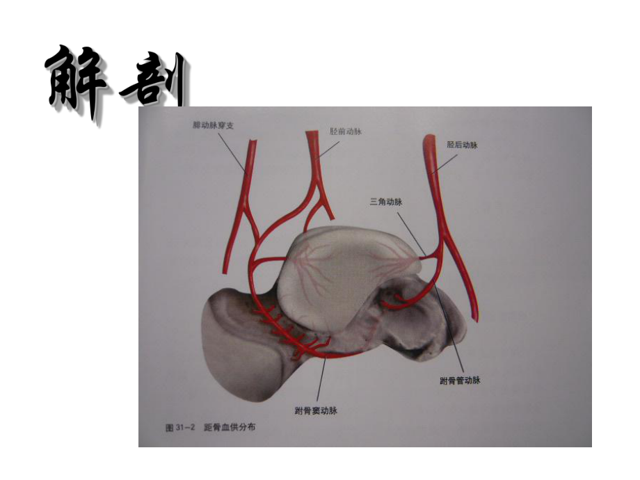 距骨坏死诊断及治疗(骨科讲课)课件.ppt_第2页