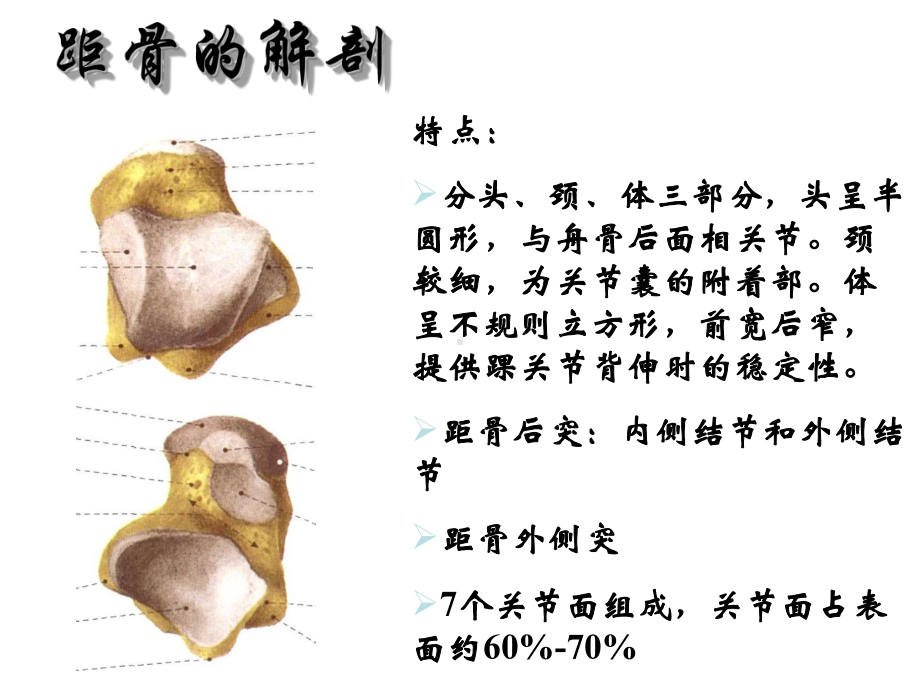 距骨坏死诊断及治疗(骨科讲课)课件.ppt_第3页