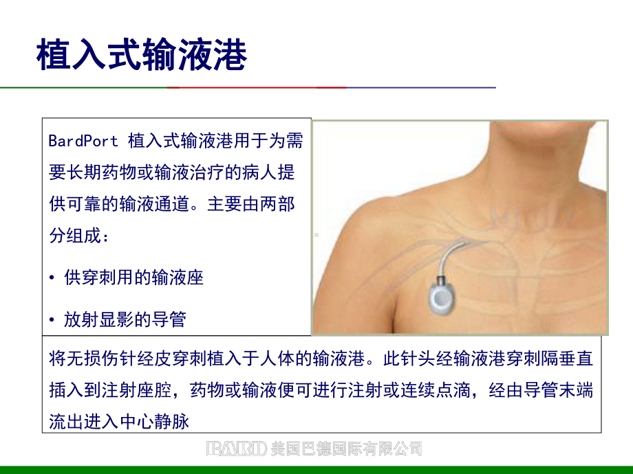 输液港护理查房PPT优质课件.ppt_第2页