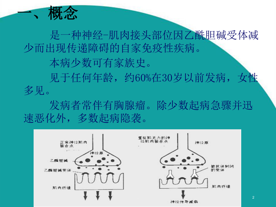 重症肌无力的护理PPT课件.ppt_第2页