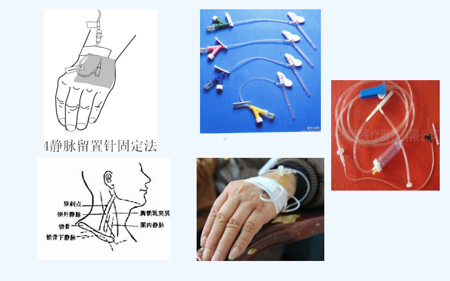 门诊输液观察及护理课件.ppt_第2页