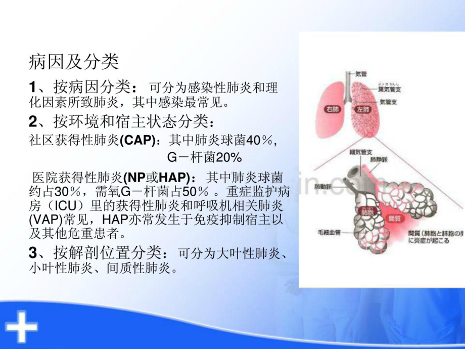 重症肺炎的护理课件.ppt_第3页