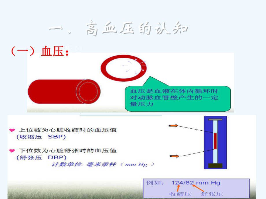 高血压防治讲座课件.ppt_第3页