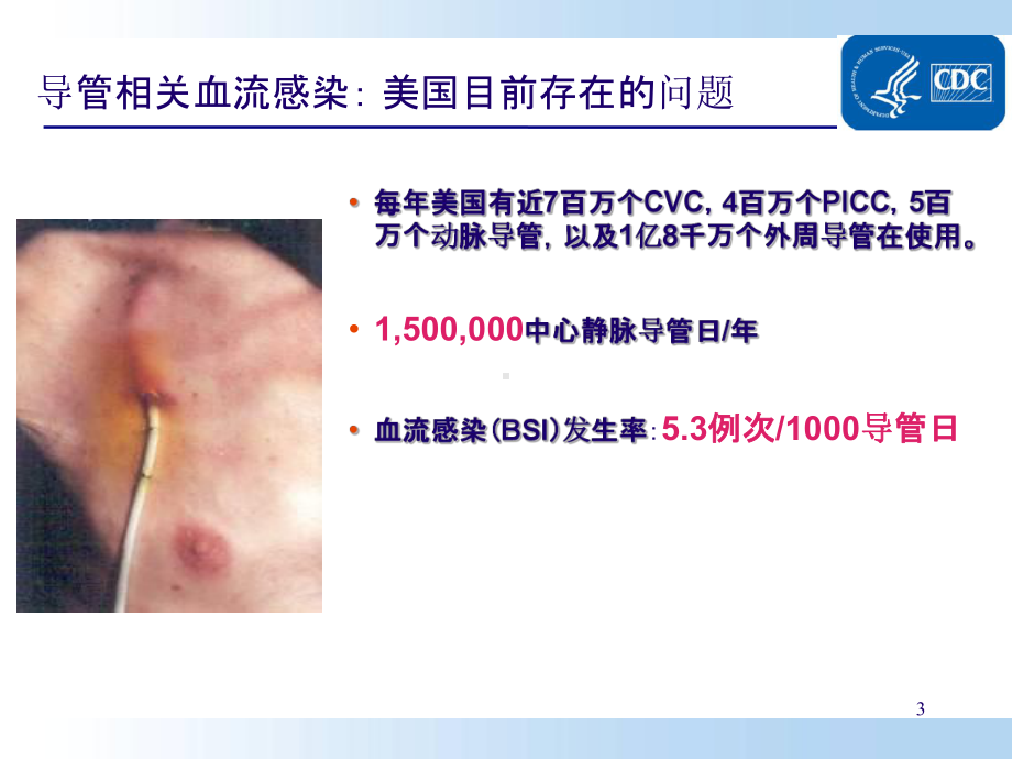 预防导管相关性血流感染(CDC指南解读)..课件.ppt_第3页