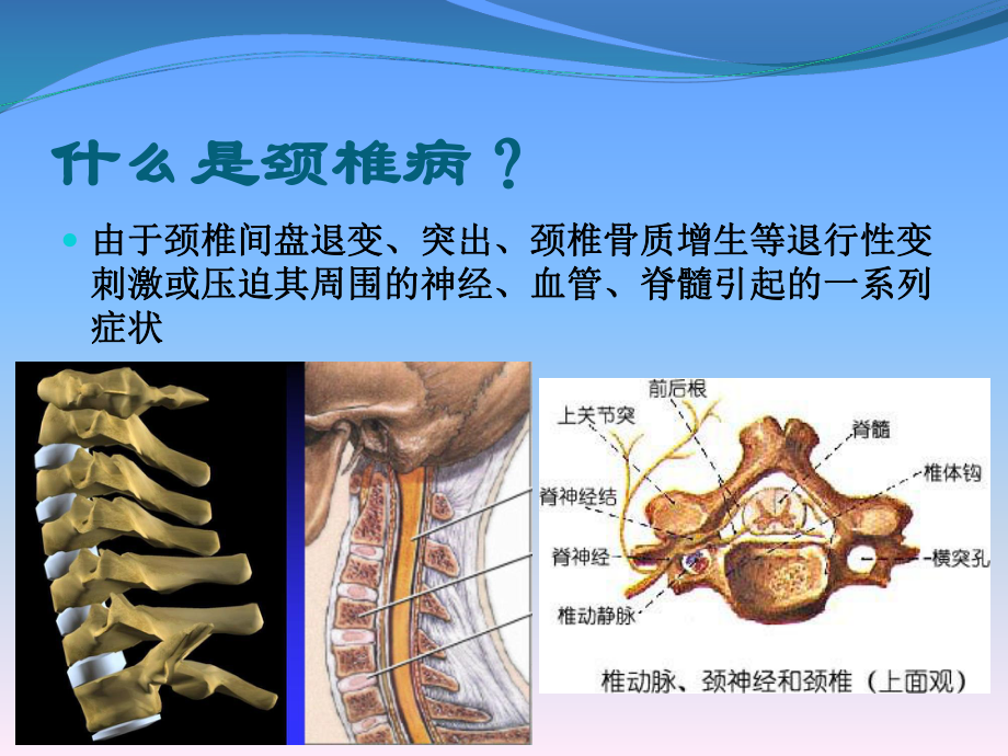 颈椎病的治疗与康复课件.ppt_第2页