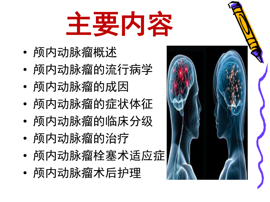 颅内动脉瘤栓塞介入术后护理课件.ppt_第2页