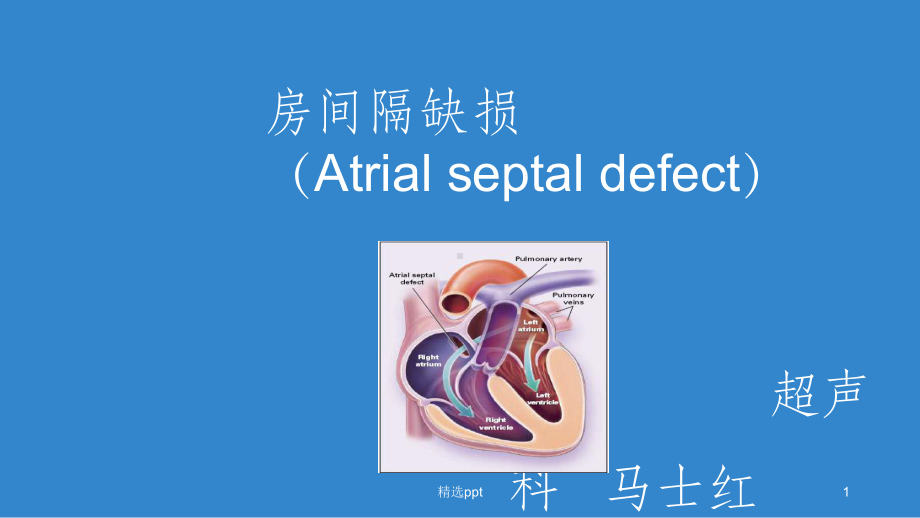 房间隔缺损PPT课件.ppt_第1页