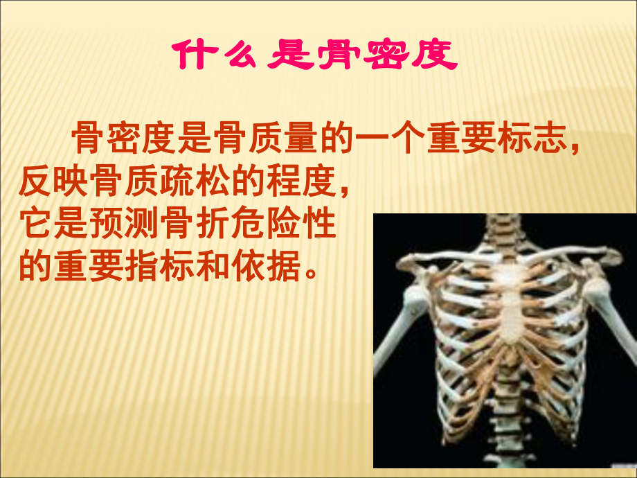 骨密度课件.ppt_第2页