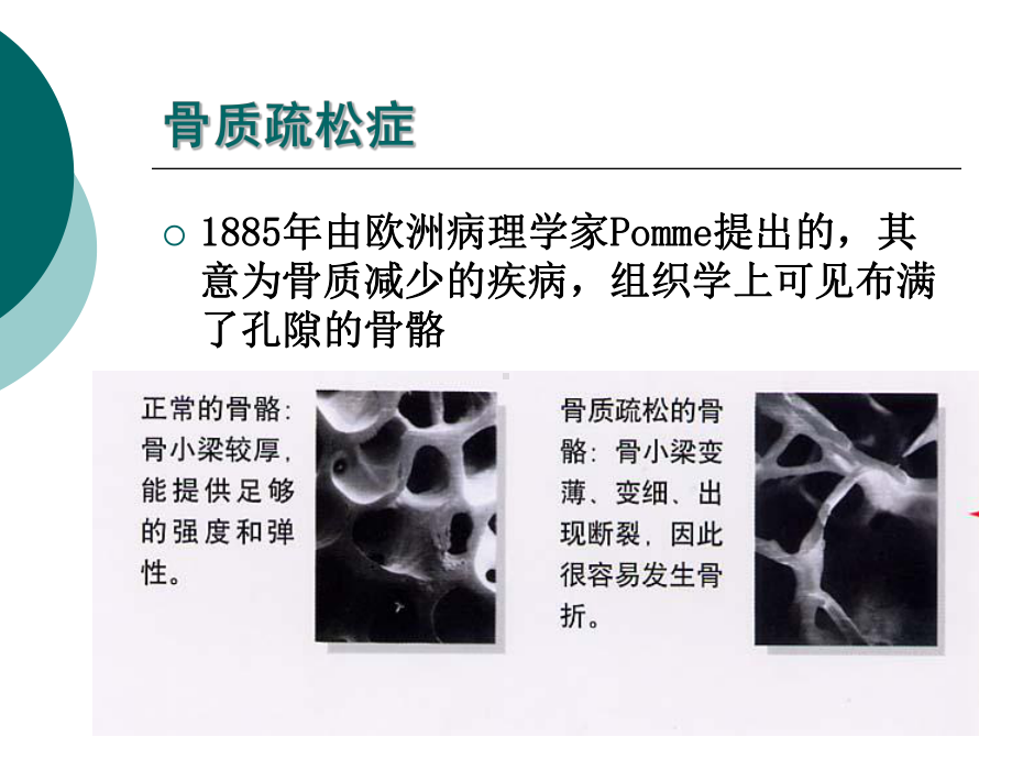 骨密度检查方案课件.ppt_第3页